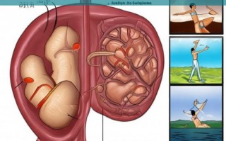 肝囊肿解析及适宜运动选择