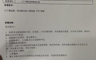 成都金牛区疫情原因，成都青羊区疫情公布小区、成都青羊区疑似病例