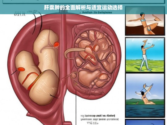 肝囊肿解析及适宜运动选择-第1张图片-东方成人网